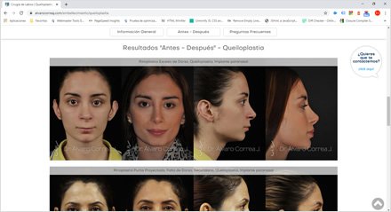 Galerías Antes-Después, Sitio web HTML5 Dr. Álvaro Correa